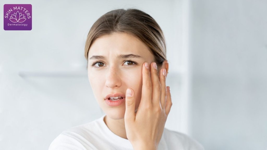 How To Remove Dead Skin After Microneedling