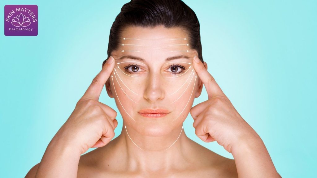 Thread Lift vs Traditional Facelift
