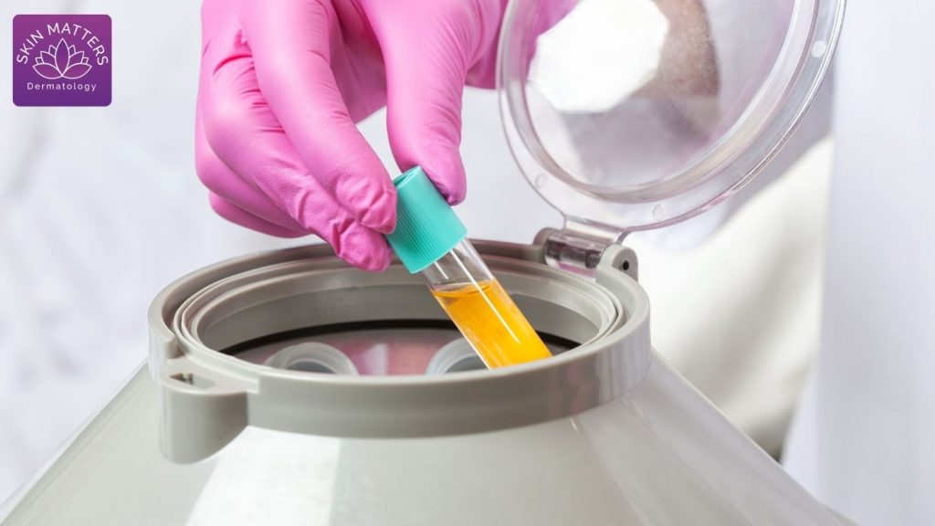 PRP and Anti-Aging